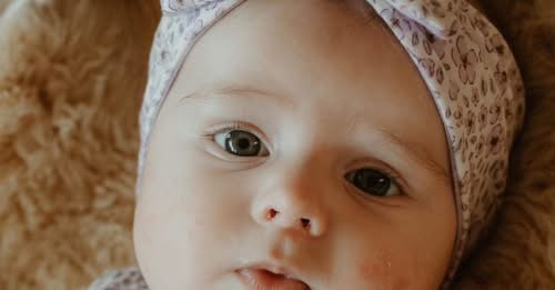 Elliana Rose Campbell Brewer Obituary: 11-Month-Old Baby Fighting Epidermolysis Bullosa, Family Appeals for Help