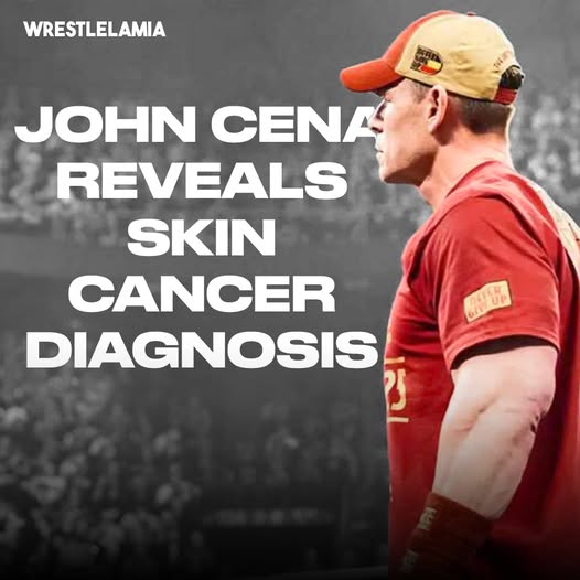 John Cena Opens Up About Skin Cancer Battle and Introduces Sunscreen Campaign